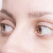 undereyebags_001
